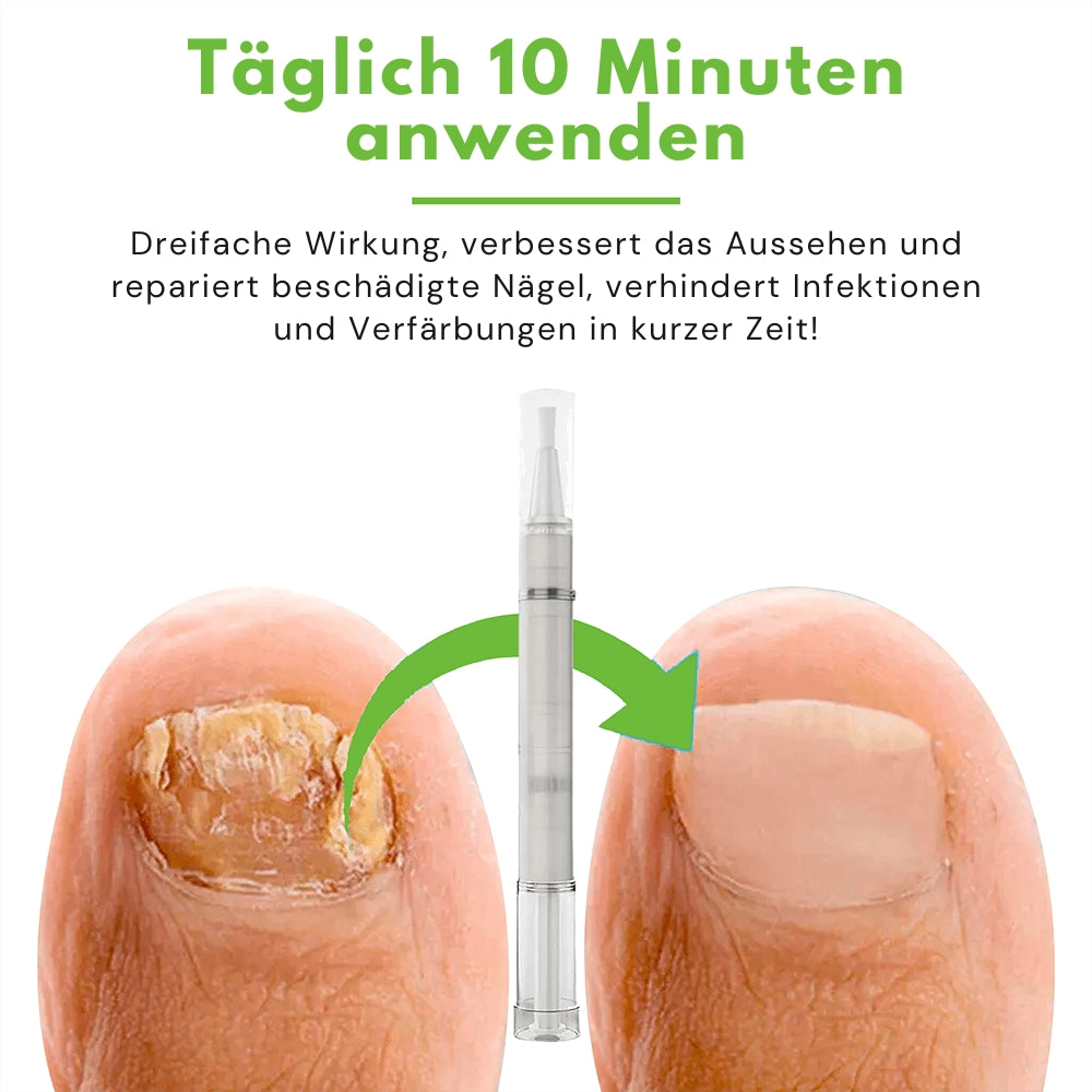 FungiGone® | Tötet Zehennagelpilz und Bakterien und sorgt für gesündere Nägel! CHF