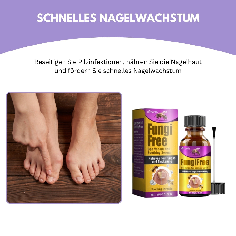 AntiFungix® | Sagen Sie Hallo zu gesunden Nägeln, Auf Wiedersehen zu Pilzen! CHF