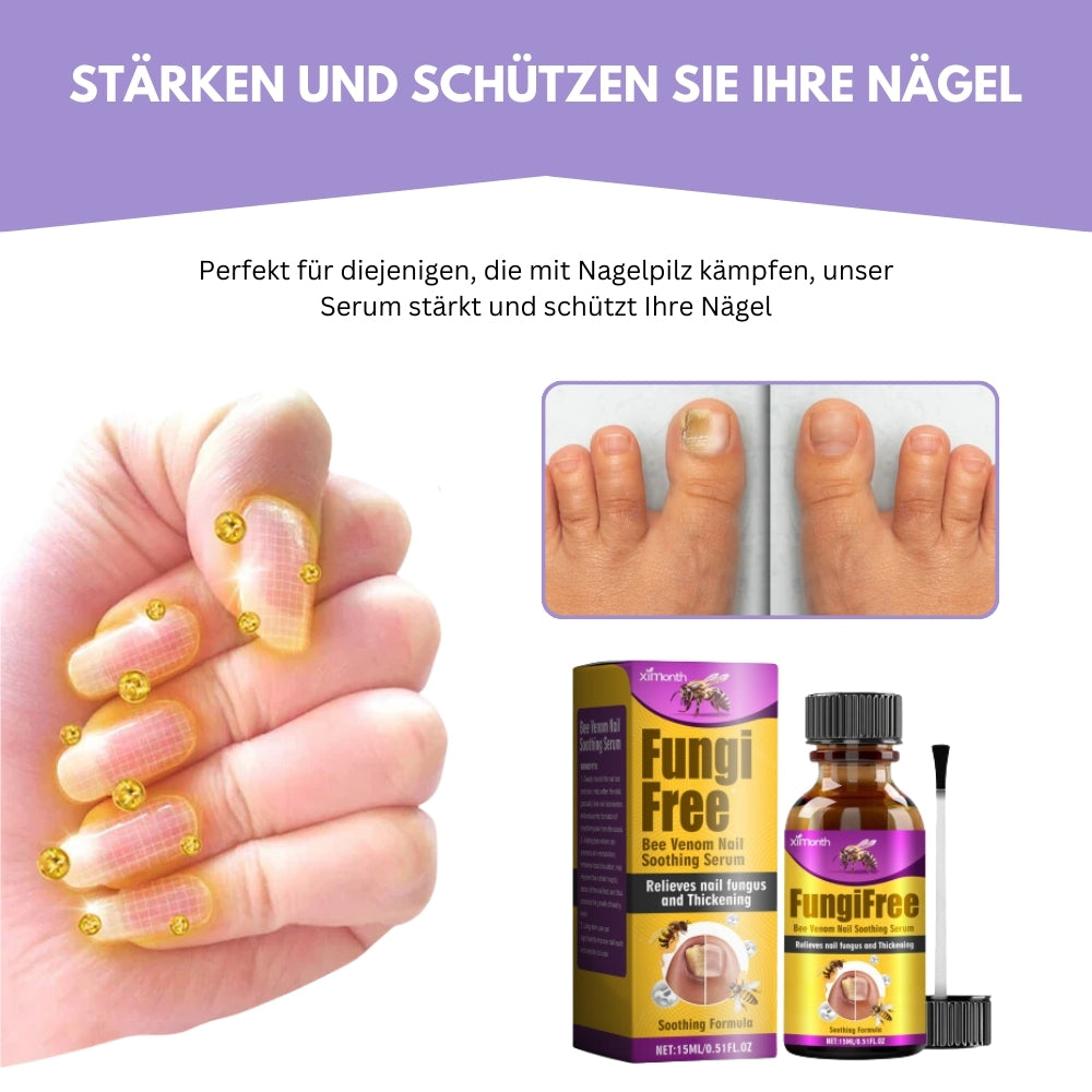 AntiFungix® | Sagen Sie Hallo zu gesunden Nägeln, Auf Wiedersehen zu Pilzen! CHF