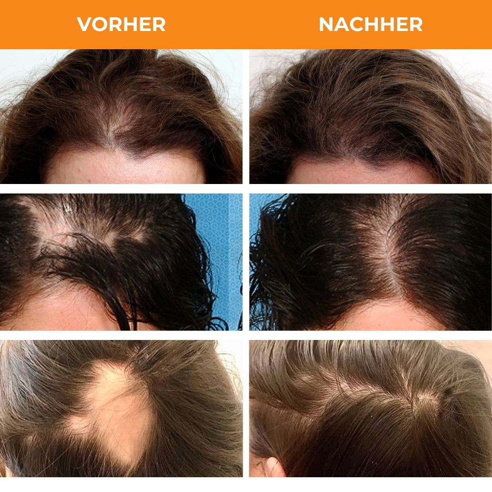 MorGan® | Sichtbar dickeres und volleres Haar in nur 7 Tagen! DE